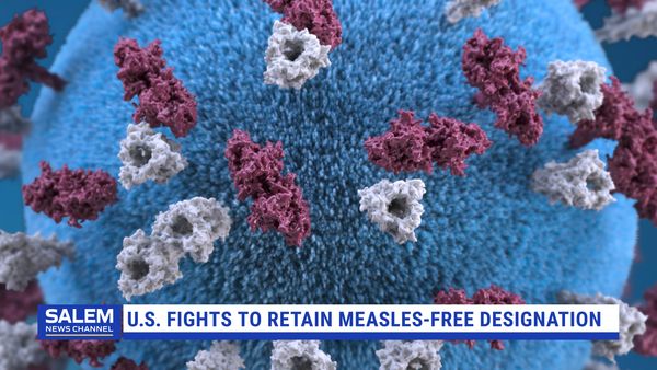 U.S. Works To Maintain Measles-Free Status