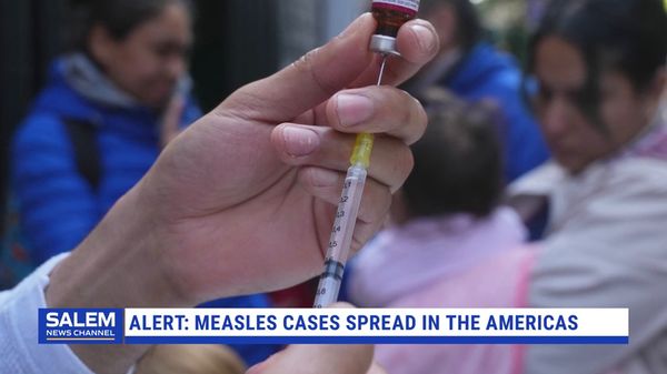 PAHO Issues Alert As Measles Cases Spread In The Americas