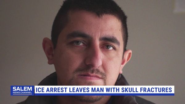 FBI, St. Paul Police Investigate ICE Arrest That Left Man With Skull Fractures