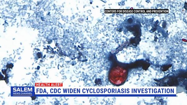 FDA, CDC Widen Lettuce-Linked Cyclosporiasis Investigation