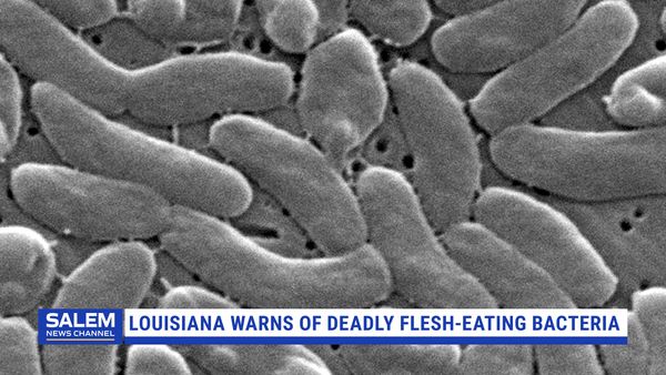 Louisiana Warns Of Deadly Flesh-Eating Bacteria