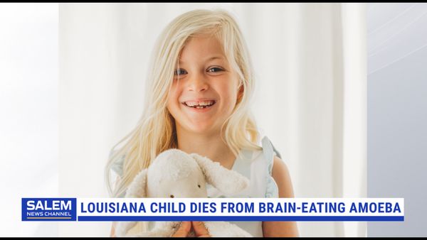 8-Year-Old Louisiana Girl Dies From Rare Brain-Eating Amoeba