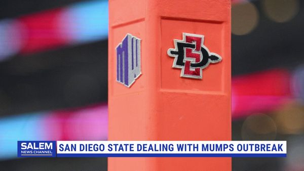 San Diego State Dealing With Mumps Outbreak
